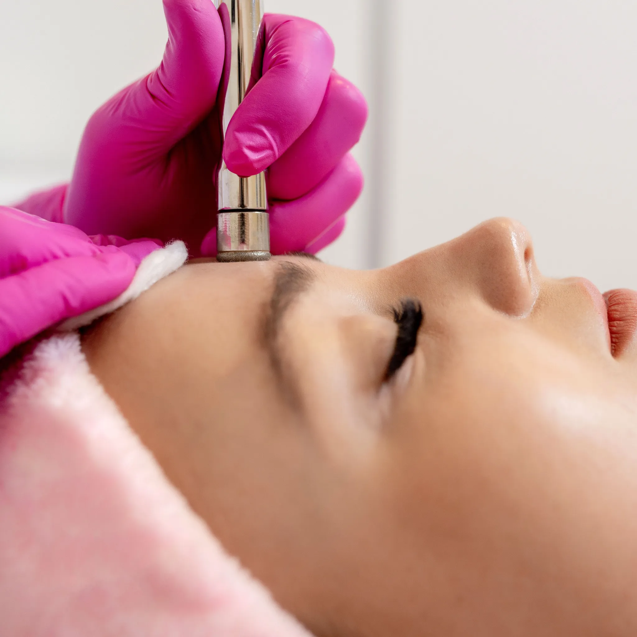 Microdermabrasion