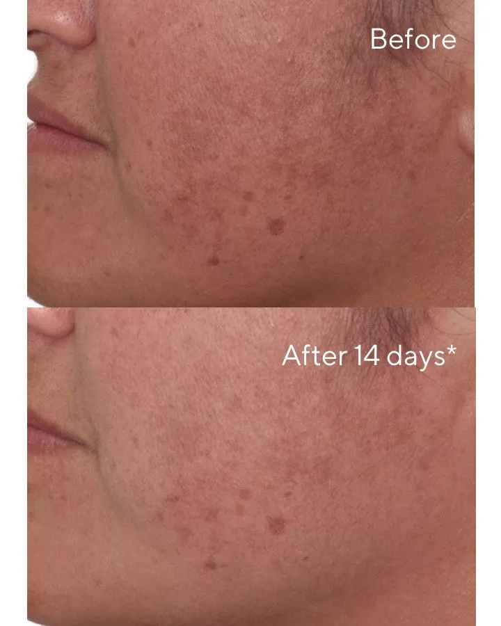 Rapid Dark Spot Correcting Serum