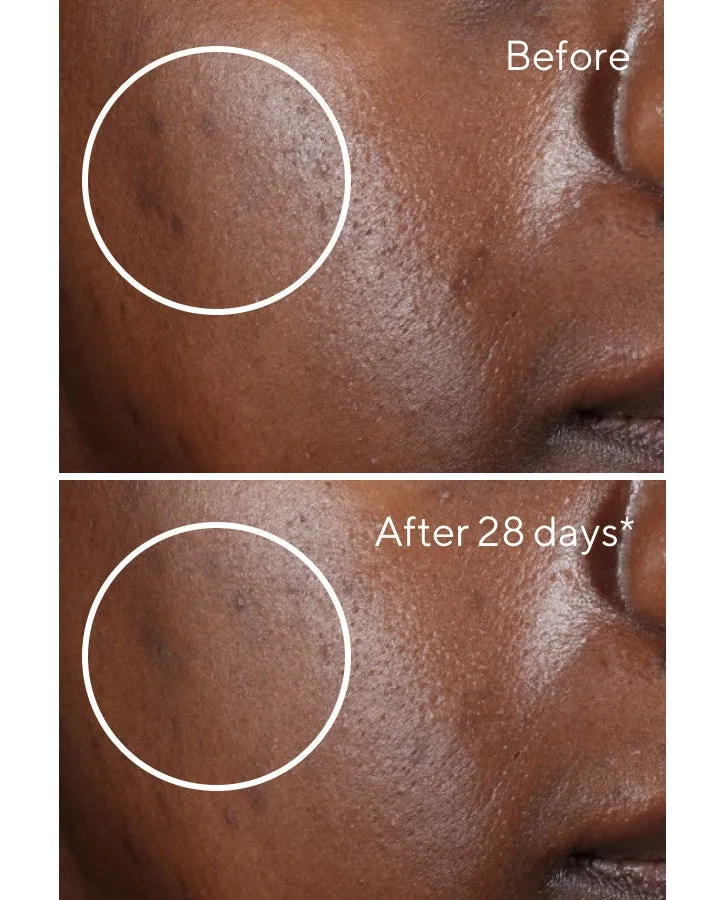 Rapid Dark Spot Correcting Serum